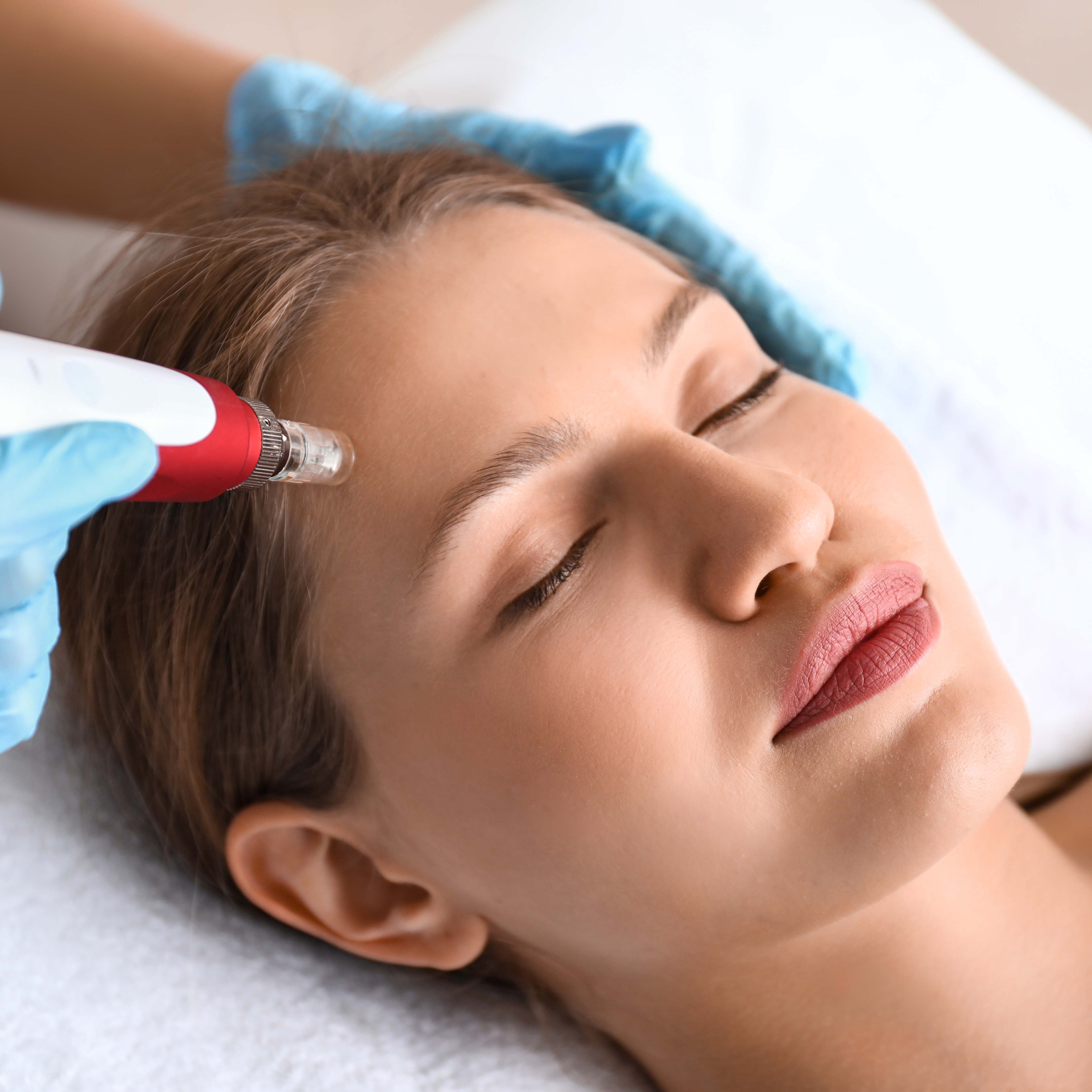 Young,Woman,Undergoing,Procedure,Of,Bb,Glow,Treatment,In,Beauty