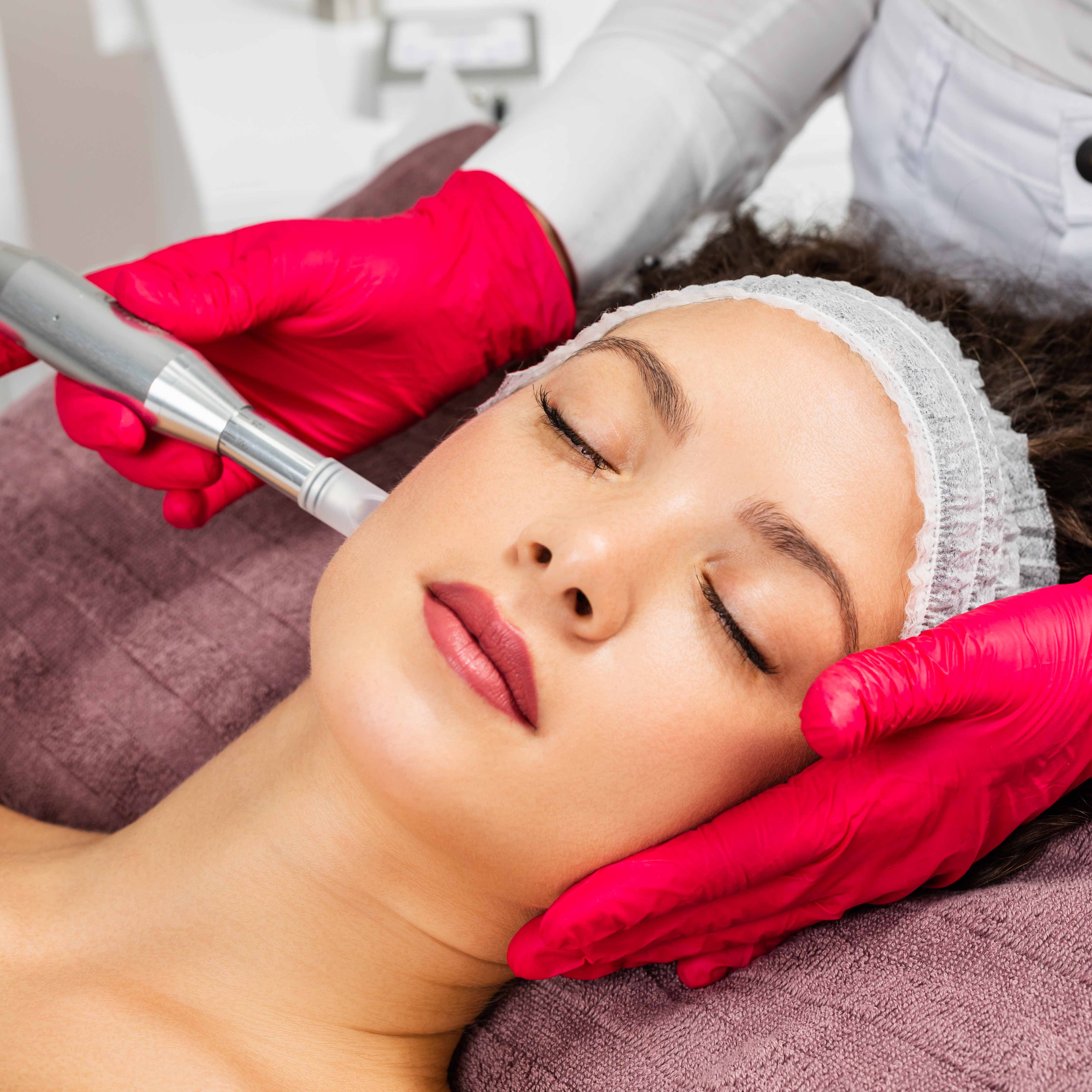 Beautiful,Woman,Receiving,Microneedling,Rejuvenation,Treatment.,Mesotherapy.